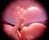 Aborto e c�lulas-tronco: Vaticano estuda temas e lan�ar� documentos