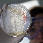 Alemanha reporta 199 novos casos de E.coli em 2 dias