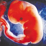 Polêmica: a ética em torno do aborto
