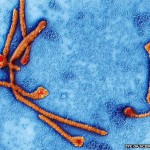 Novo tratamento contra ebola atinge 90 % de eficácia