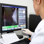 40% das brasileiras de 50 a 69 anos não fazem mamografia