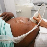 Bebês expostos ao Zika no fim da gravidez não são afetados, diz estudo