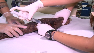 Instituição no ABC paulista cuida de animais feridos nas ruas