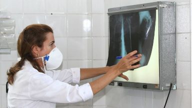 OMS: tratamento da tuberculose não deve ser descuidado