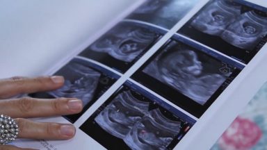 Naprotecnologia: esperança para casais que não conseguem ter filhos