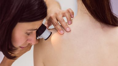 Segundo INCA, casos de câncer de pele em 2020 são preocupantes