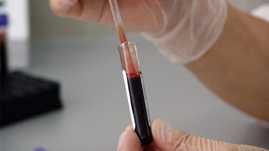 Junho Laranja: campanha reforça cuidados com a saúde do sangue