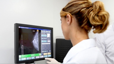 Especialista alerta para importância da mamografia