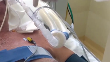 Tomógrafo criado por brasileiros reduz o uso de