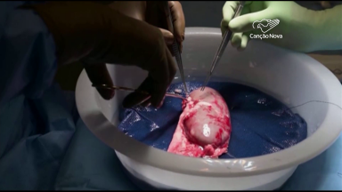 Brasil pode testar transplante de rim de porco em humanos em dois anos