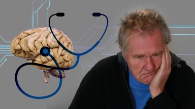 Professor explica como adiar os sintomas do Alzheimer
