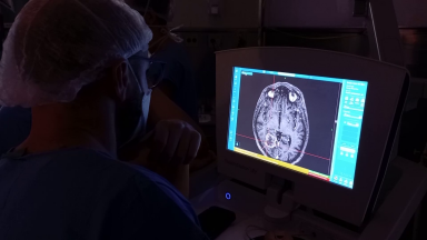 Pesquisadores buscam opção para tratamento de tumor cerebral