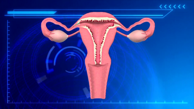 Mês de março tem campanha de conscientização sobre endometriose
