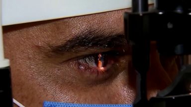 Médico oftalmologista fala sobre cuidados e tratamento do glaucoma