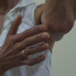 Centros de referência atuam para detectar hanseníase logo no início