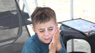 Proteção contra o sol é chave no combate ao câncer de pele