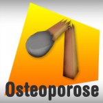 Osteoporose: veja como poupar o cálcio dos seus ossos