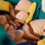Quais são os maiores interesses no uso de fetos abortados?