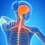Esclerose Múltipla: o que é e quais são os sintomas?