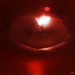 O que está por trás da indústria do aborto?