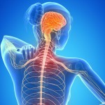 Esclerose Múltipla: o que é e quais são os sintomas?